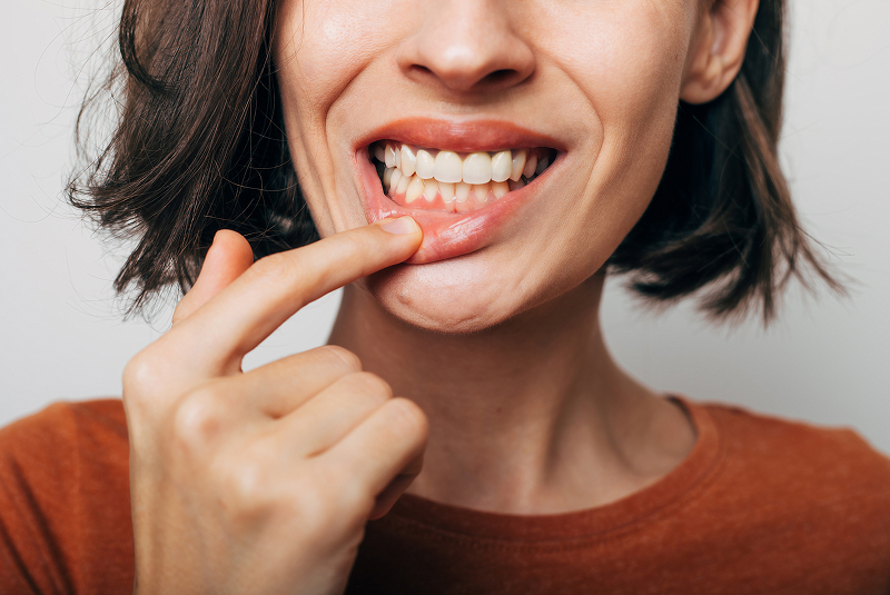 showing gum disease